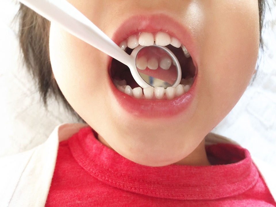 子どもの歯を守る小児歯科｜むし歯予防を大切にした診療