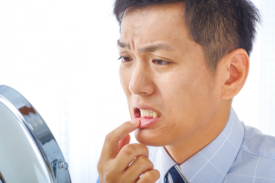 歯の黄ばみの原因とは？ホワイトニングで改善できる？